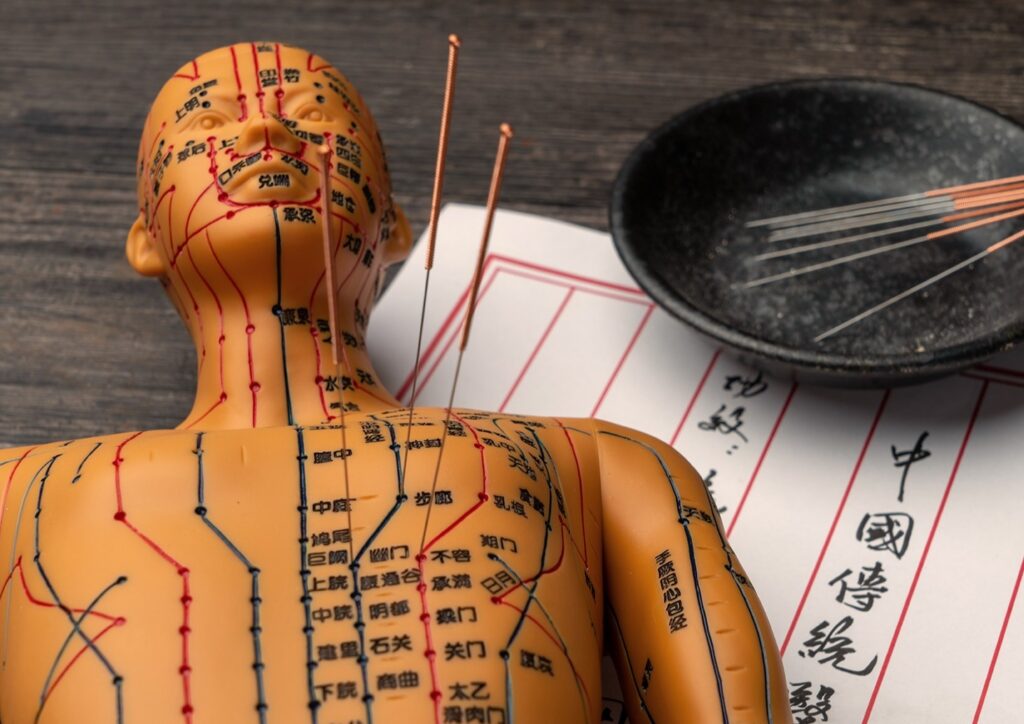 acupuncture points needles and tcm scroll update